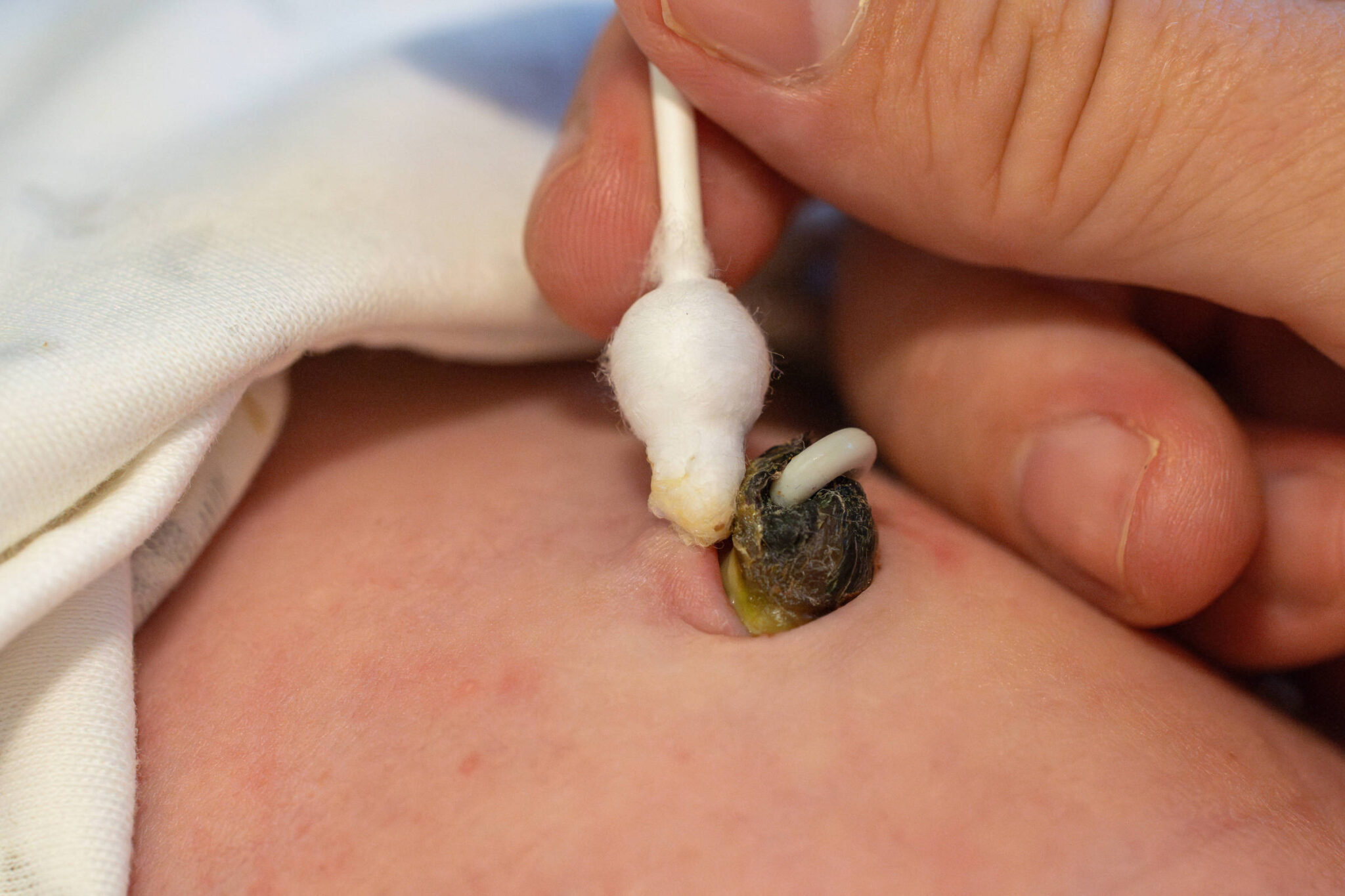 os-riscos-de-guardar-e-consumir-tecido-humano,-como-cordoes-umbilicais