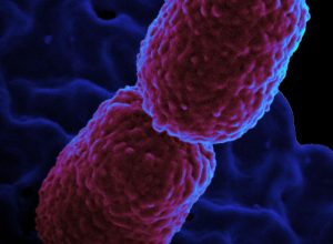 hospital-em-campinas-restringe-atendimento-para-conter-superbacteria